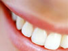 dentatura perfetta