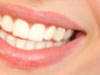 sorriso