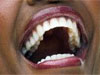 denti sani